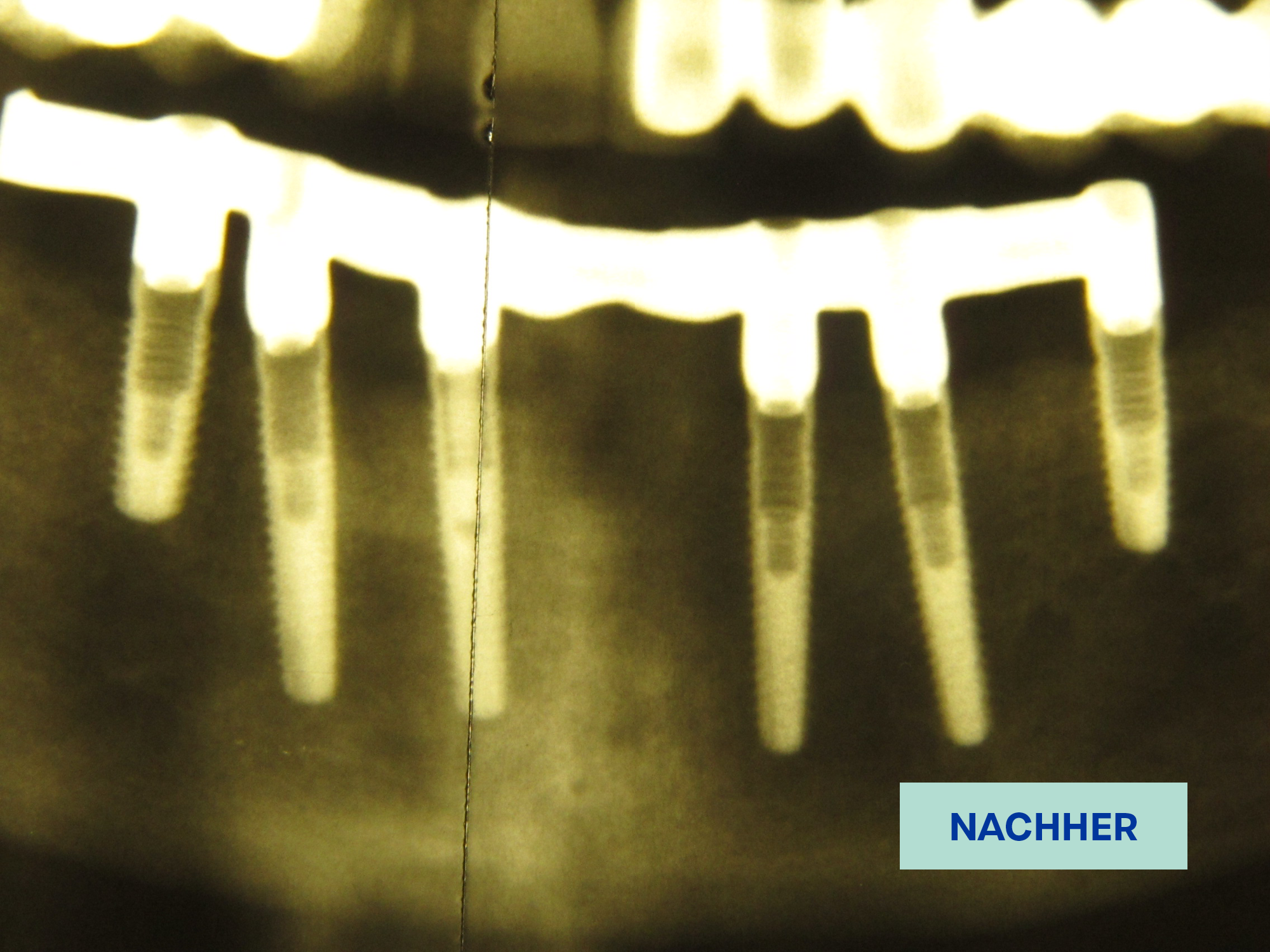 2.3.Kombiarbeit_nachher